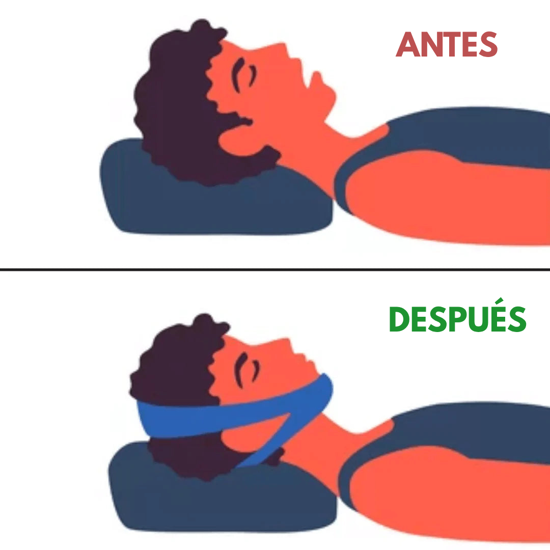 Correa para la Mandíbula Mandyx™